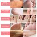 Factory Custom Foot Peel Mask 5er Pack für rissige Fersen, abgestorbene Haut &amp; Schwielen